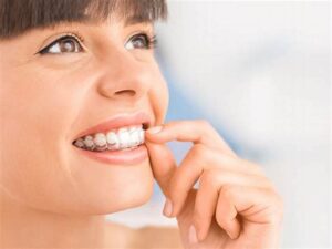 invisalign treatment ringwood