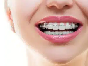 eating soft foods-with braces