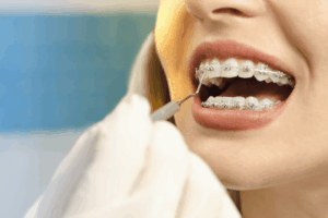 managing braces discomfort first week