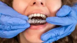 Patient inserting a clear aligner