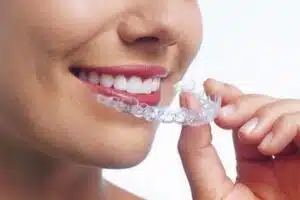 clear invisalign aligner jaw bite alignment